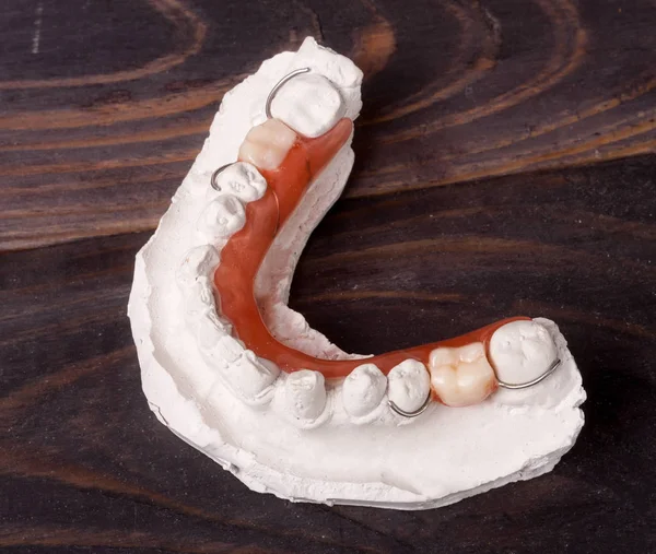 Gipsowy zębów z protezą częściowe na ciemnym tle drewnianych — Zdjęcie stockowe