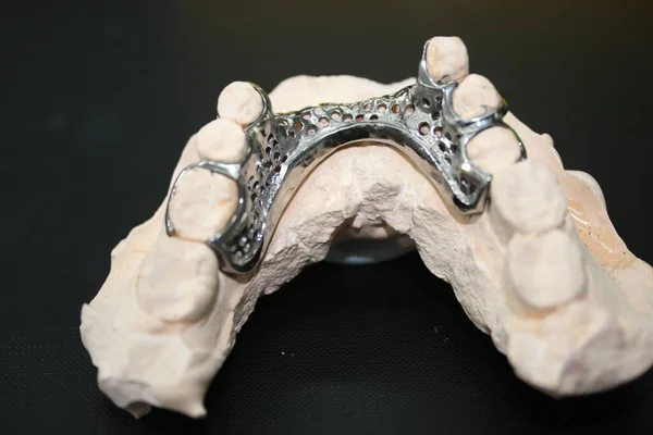 dental model with a toy jaw