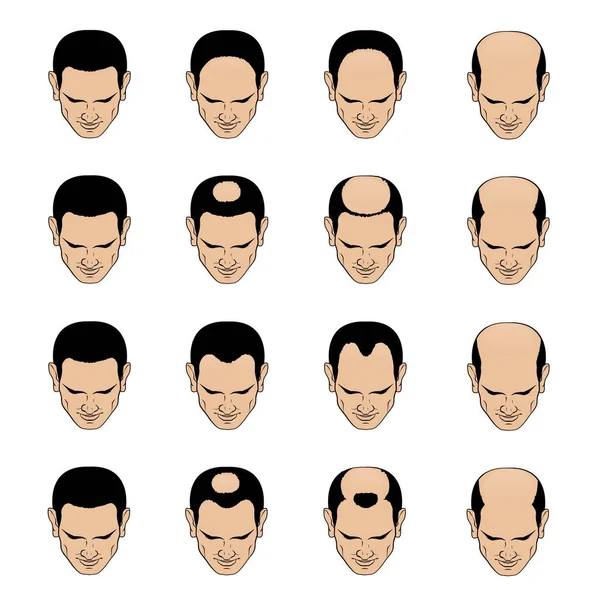 Hairl kaybı desen ve aşamaları erkekler için