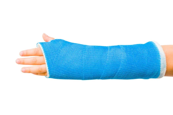 Cast of Child���s Broken Arm Isolated on White Background — Stock Photo, Image