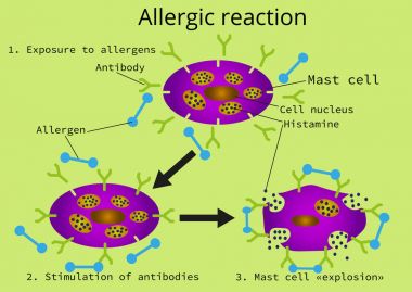 Alerjik bir reaksiyon üç aşamadan