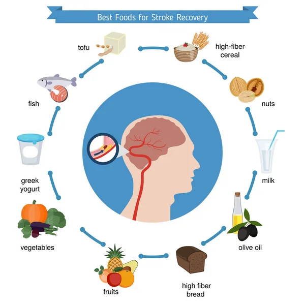 Los mejores alimentos para la recuperación de accidentes cerebrovasculares — Vector de stock