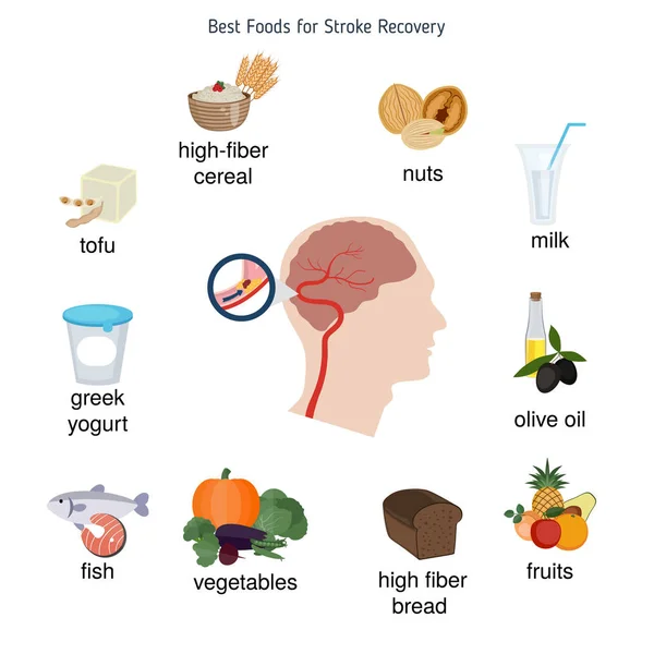 Los mejores alimentos para la recuperación de accidentes cerebrovasculares — Archivo Imágenes Vectoriales