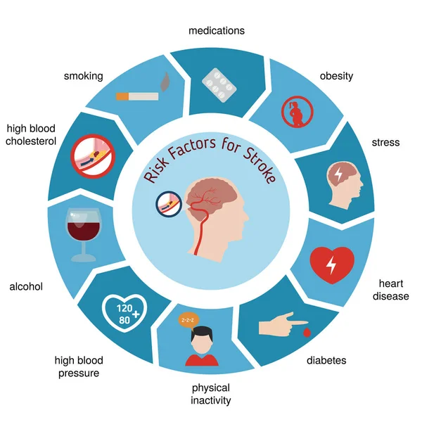 Infografías para derrame cerebral — Vector de stock