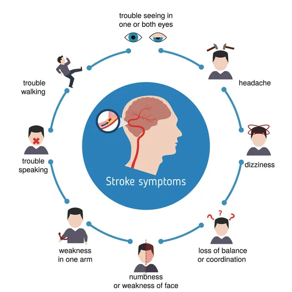 Infografiki udaru mózgu — Wektor stockowy