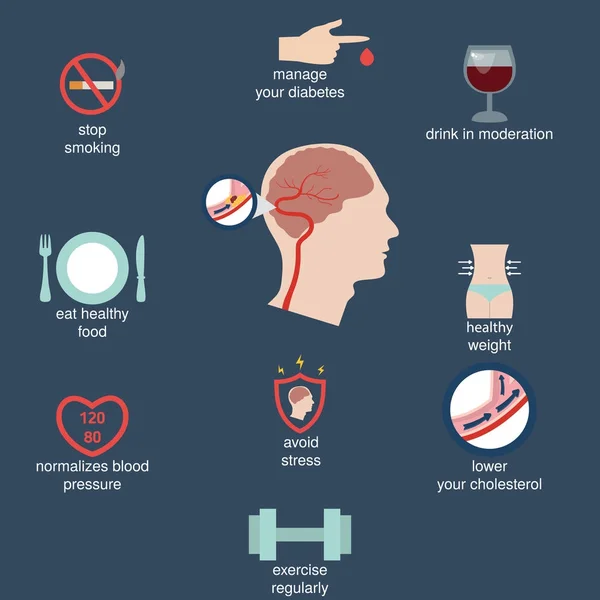 Infografías para derrame cerebral — Vector de stock