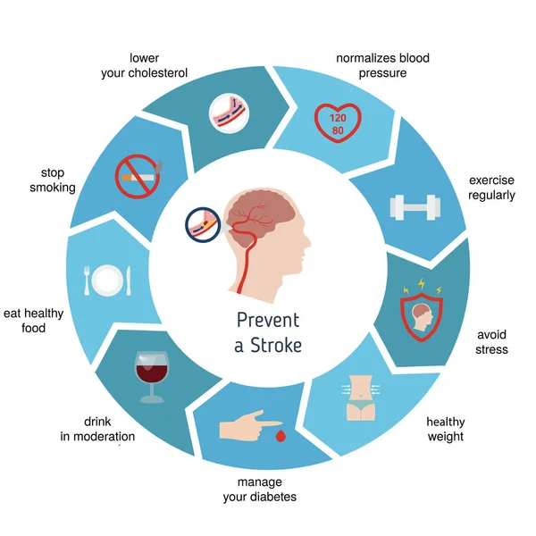 Infografiki udaru mózgu — Wektor stockowy