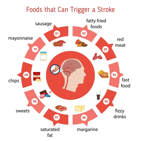 Infografik för stroke — Stock vektor