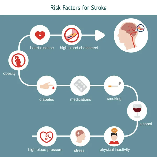 Infografiki udaru mózgu — Wektor stockowy