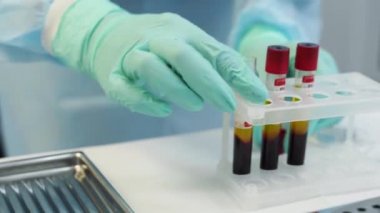 Eldivenli doktor, Çin koronavirüsünün analizi için kan test tüpleriyle çalışıyor. Bilim adamı teknisyen plazmayı pompalamak için şırıngayı boş yere koyuyor. Covid virüs salgını ve biyokimya kavramı.