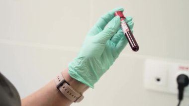 Eldivenli doktor, Çin koronavirüsünün analizi için kan testi tüpünü sallıyor. Bilim adamı teknisyeni, steril boştayı laboratuvarda karıştırıyor. Covid virüs salgını aşısı geliştirme, biyoteknoloji.