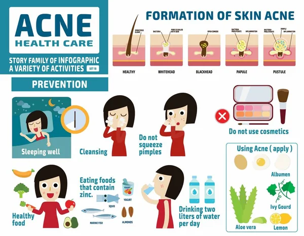 Acne en beschermen. gezondheidszorgconcept. infografische elementen. plat schattig cartoon ontwerp illustratie. — Stockvector