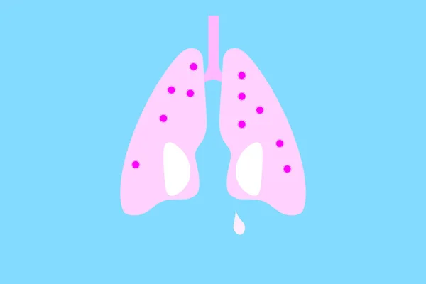 肺とウイルスのフラットデザインイラスト — ストックベクタ
