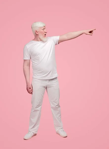 Macho albino asombrado apuntando a un lado —  Fotos de Stock
