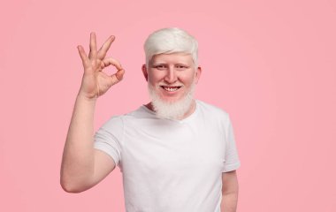 Gülümseyen albino adam, tamam mı?