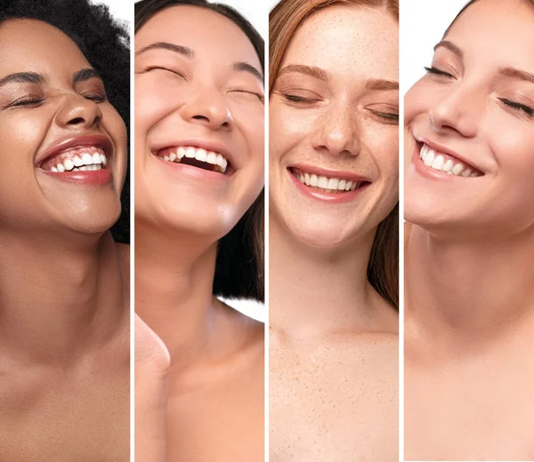 Різні веселі жінки з чистими білими зубами — стокове фото