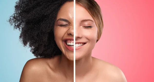 Vrolijke multi-etnische dames lachen met gesloten ogen — Stockfoto