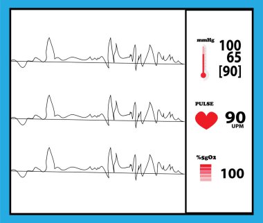 Sağlık makine İzleyicisi dedektörü
