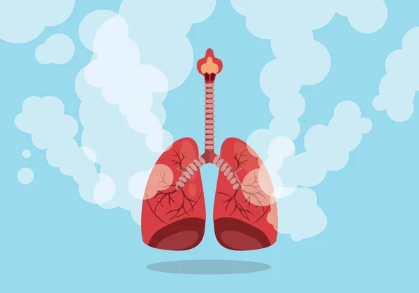 Pulmones en el humo signo poco saludable con plano azul fondo estilo vector — Vector de stock