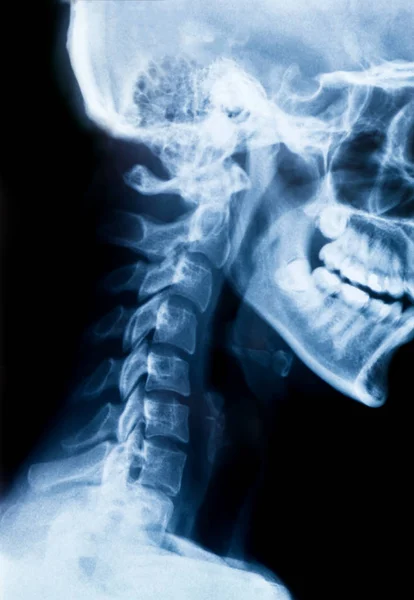 X-ray of the neck and skull - side view