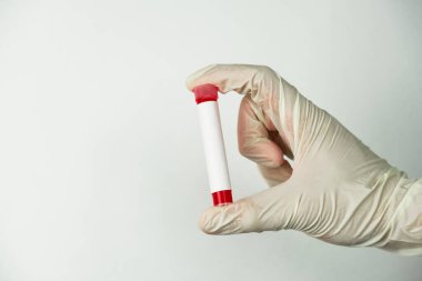 Bir tıp uzmanının eli boş bir kan testi tüpü tutarken beyaz arka planda sahte bir etiket, boşluğu kopyala