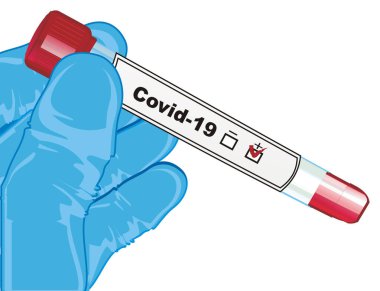 Coronavirus testi ile test tüpü