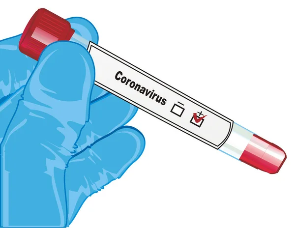 Tubo Ensayo Con Prueba Coronavirus — Foto de Stock