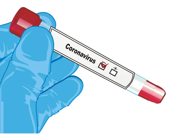 Probeta Prueba Del Coronavirus — Foto de Stock