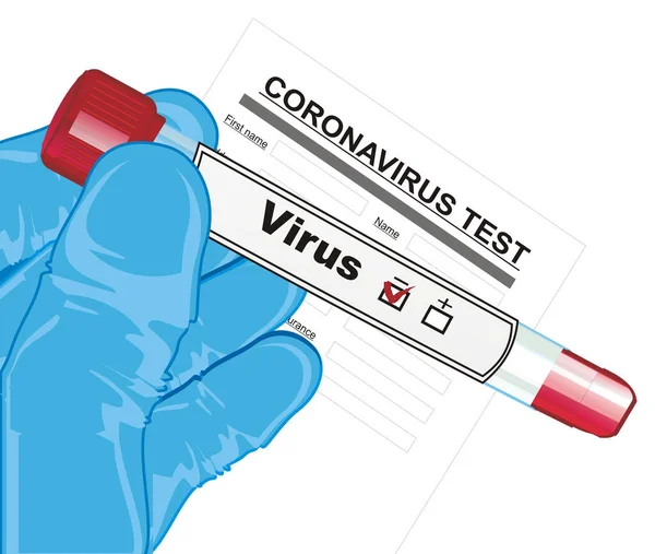바이러스 검사가 시험관 — 스톡 사진