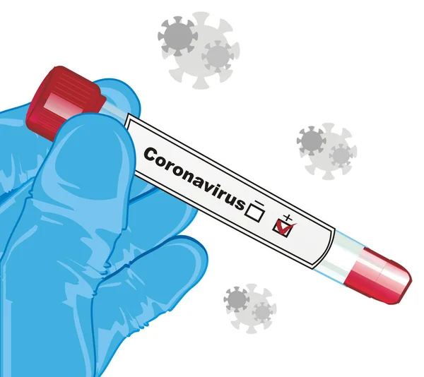 test tube with coronavirus positive test