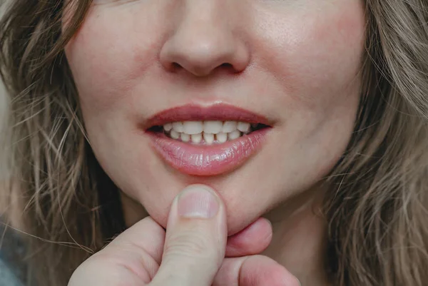 Dedo masculino en la barbilla femenina debajo de los labios. La mano sostiene la barbilla —  Fotos de Stock