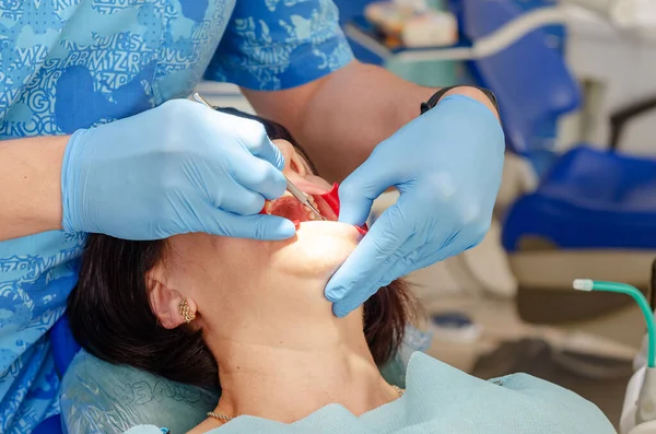 Pacjent dentysta na krześle, usta otwarte — Zdjęcie stockowe