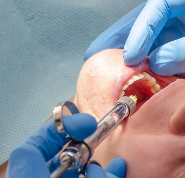 Läkaren ger bedövning injektion till patienten på tandvårdskliniken — Stockfoto