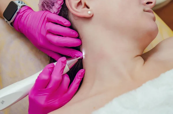 Extracción de papilomas en el cuello en un salón de belleza — Foto de Stock