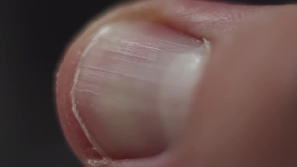 Ανθρώπινο χέρι μακροεντολή καρφί αντίχειρων εσωτερικη — Αρχείο Βίντεο