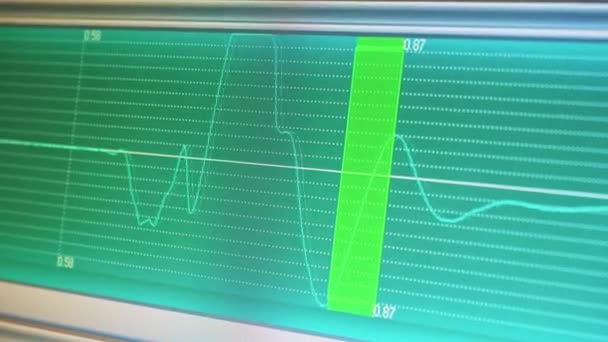 Pantalla Monitor Con Imagen Ondas Alta Frecuencia Análisis Diagnóstico Equipo — Vídeo de stock
