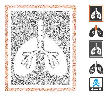Dash Mozaik Akciğerleri X-Ray Fotoğraf Simgesi