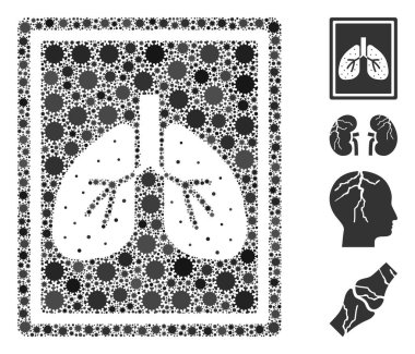 CoronaVirüs Simgelerinin Florografi Kolajı