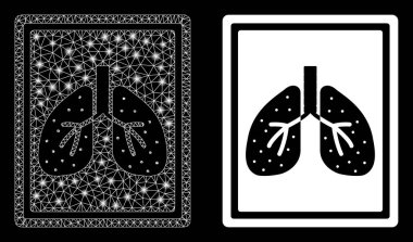 Parlak Ağ Akciğerleri Flare Benekli Florografi