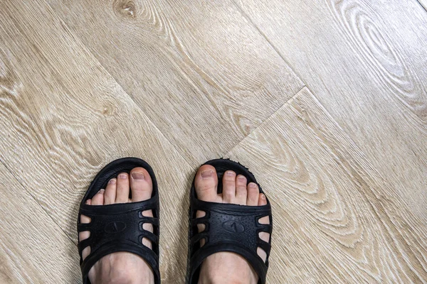 Los pies desordenados sin una pedicura zapatillas de goma en el suelo de laminado. Aislamiento forzado en cuarentena Covid-19 — Foto de Stock