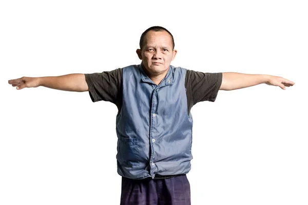 Portrait of a man with down syndrome. Isolated on white backgrou — Stock Photo, Image