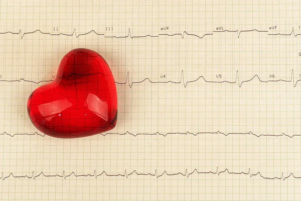 Arka plan olarak yazdırılan EKG