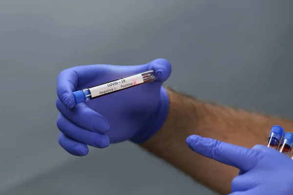 Testování Koronavirus Ruce Drží Zkumavky Obsahující Vzorky Krve Pacienta Výsledky — Stock fotografie