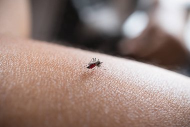 İnsan derisi üzerinde tükürük, kan emen sivrisinek yakın çekim 