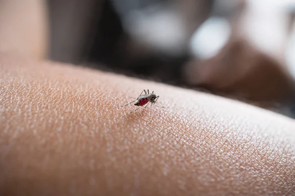 A szúnyog vért szívó az emberi bőrön, a nyál közelről — Stock Fotó