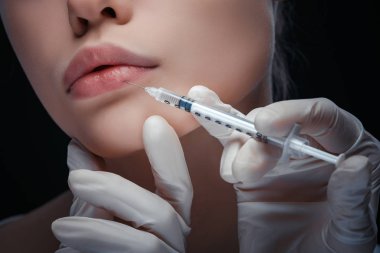 Ayrıntılı bir dudak enjeksiyon görünümünü kapat