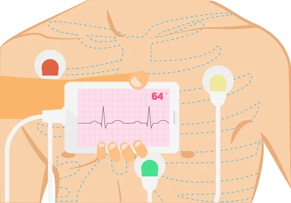 Eletrocardiografia móvel ilustração conceitual. Mão segurando smartphone com faixa de ecg — Vetor de Stock