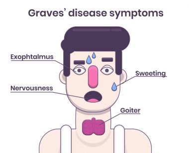 Graves' Disease symptoms. Young caucasian man with goiter clipart
