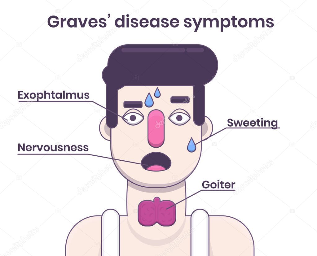 Graves' Disease symptoms. Young caucasian man with goiter