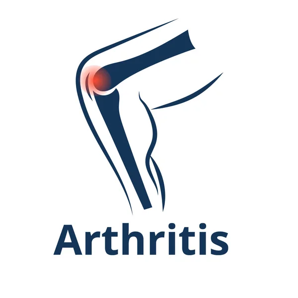 Icône vectorielle de l'arthrite du genou. Concept de douleur articulaire du genou — Image vectorielle